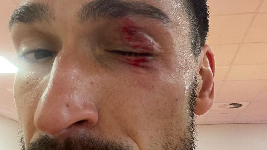 Mats Hummels, Fußballspieler