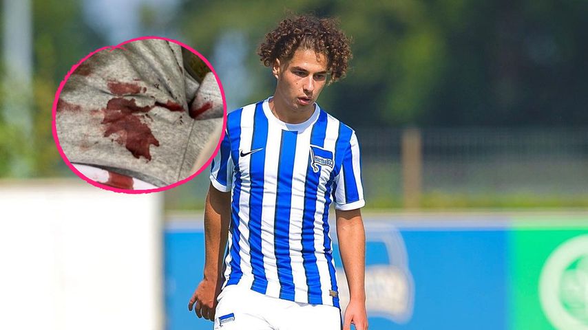 Hertha-Profi fliegt durch Glasscheibe und wird notoperiert!
