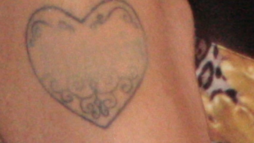 Endgültig! Melanie Griffith entfernt Liebes-Tattoo