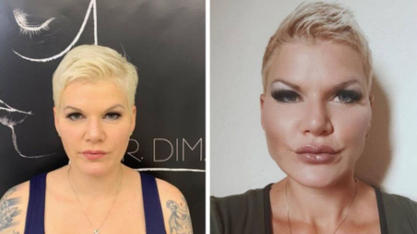 Superhappy: Melanie Müller zeigt Gesicht nach Beauty-OPs