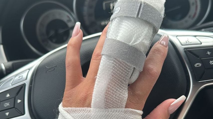 Menowin Fröhlich postet verletzte Hand seiner Freundin Ronja, September 2025