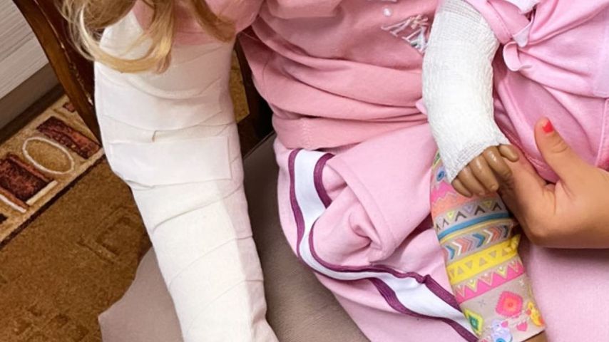 Mia Rose Harrisons gebrochener Arm