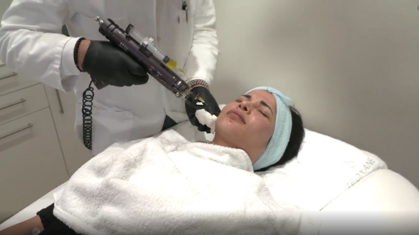 "Erotikbranche knallhart": Mica Schäfer macht Vampir-Lifting