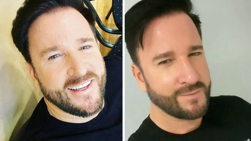 Nach OP-Eingriff: Michael Wendler zeigt sein neues Näschen
