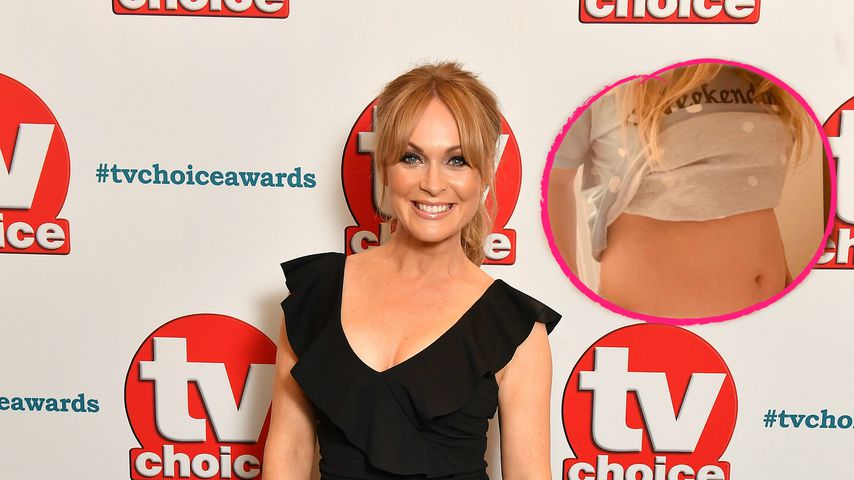 "Emmerdale"-Star Michelle Hardwick zeigt ihren Babybauch