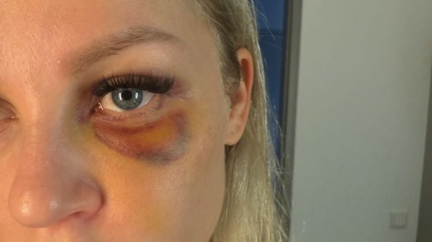 "Gewalt erlebt": Michelle Schellhaas teilt langes Statement