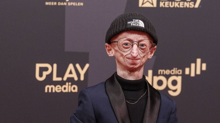Influencer Michiel Vandeweert mit 28 an Progerie verstorben