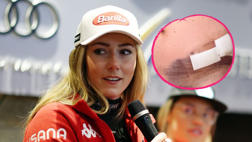 Mikaela Shiffrin teilt Horrorbilder ihres Skiunfalls im Netz