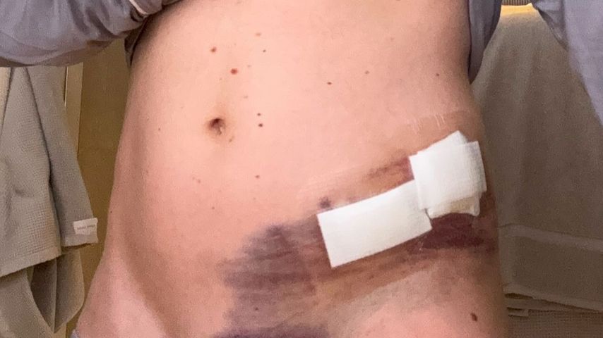 Mikaela Shiffrin nach einem Skiunfall