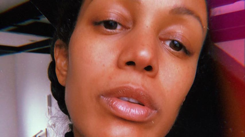 Milka Loff Fernandes für ungeschminktes Gesicht beleidigt