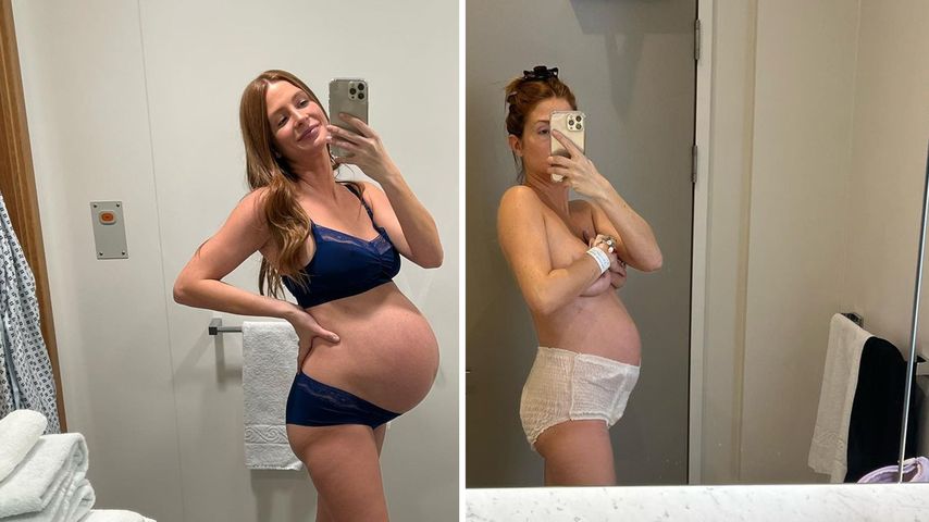 Millie Mackintosh teilt Vorher-Nachher-Fotos von der Geburt
