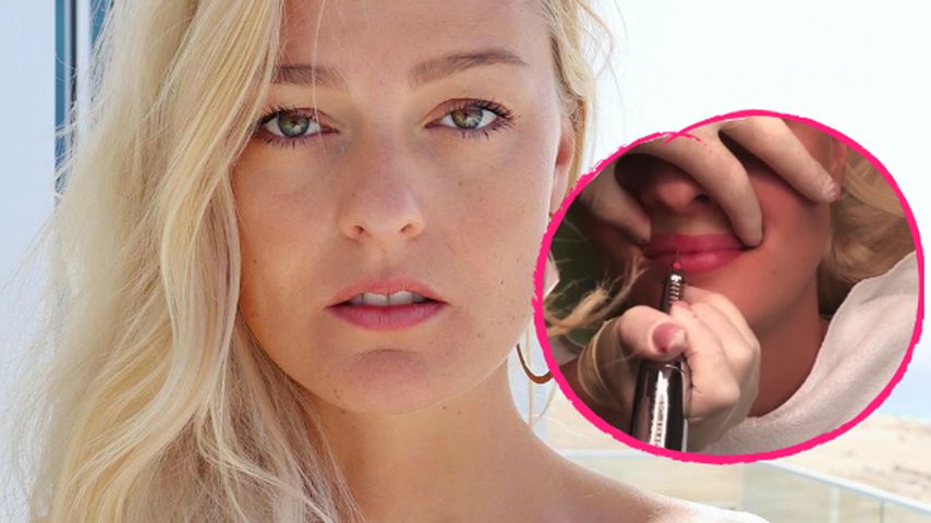 Ex-Stuntfrau Miriam Höller lässt sich Lippen pigmentieren