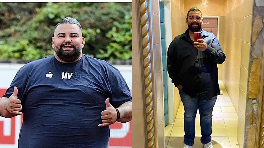 "Biggest Loser"-Mokka hat sich den Magen verkleinern lassen