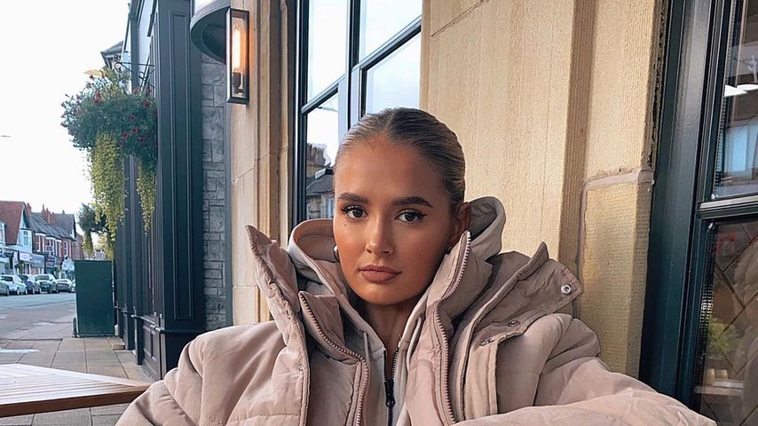 Molly-Mae Hague nach der Entfernung ihrer Lipfiller