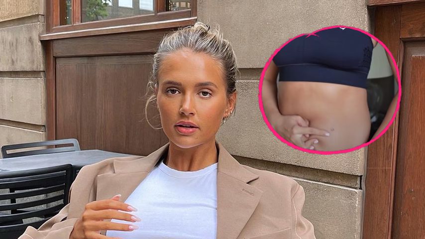 Nach Endometriose-OP: Molly-Mae Hague zeigt ihre Narbe!