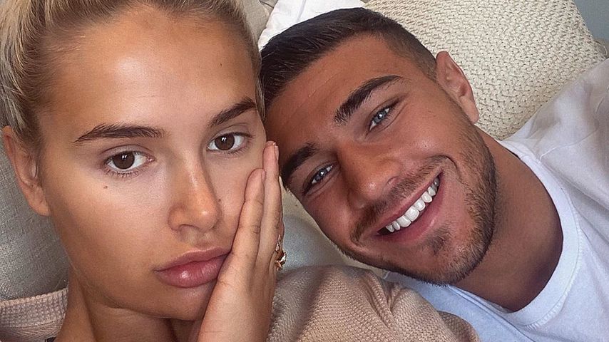UK-"Love Island"-Star: Freund bricht ihr aus Versehen Nase!