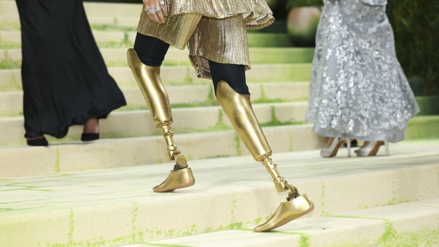Lauren Wassers Goldprothesen, die sie bei der Met Gala 2026 im Metropolitan Museum of Art in New York trug