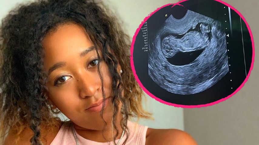 Tennis-Superstar Naomi Osaka ist zum ersten Mal schwanger!