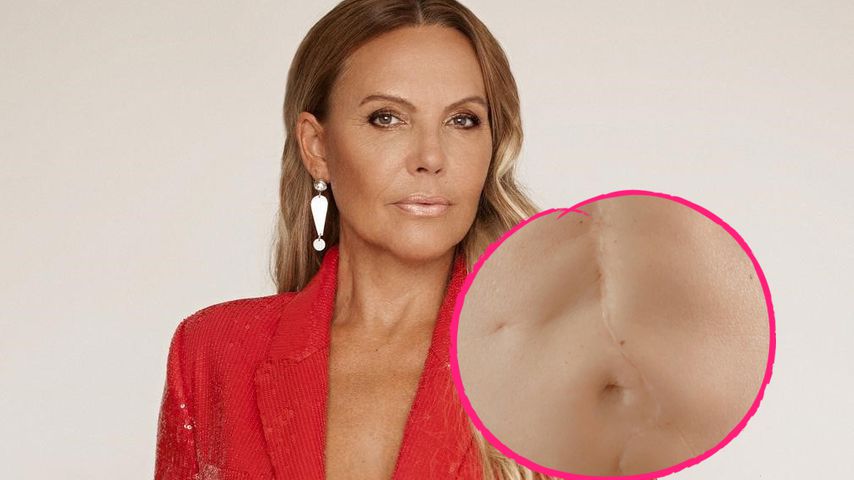 "Einzigartig": Natascha Ochsenknecht zeigt ihre Bauchnarbe