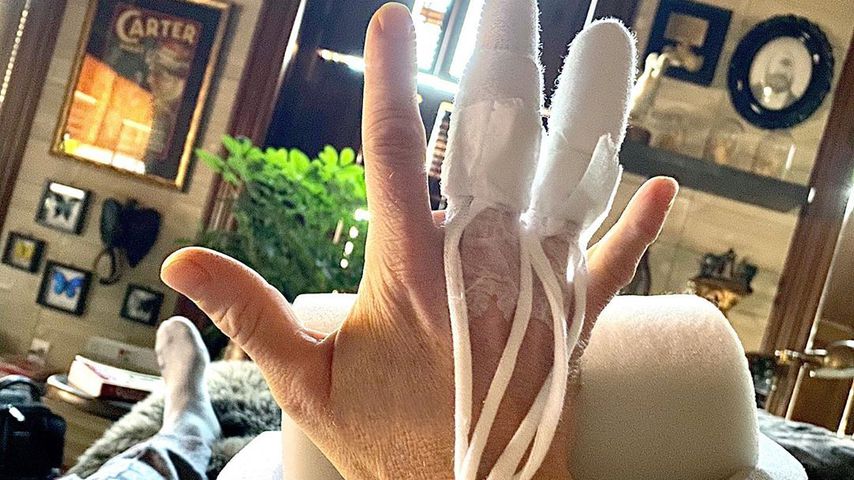 Neil Patrick Harris nach seiner OP