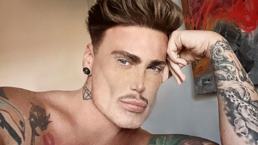Nach Nasen-OP: Model Neven Ciganovic hatte Dauererektion