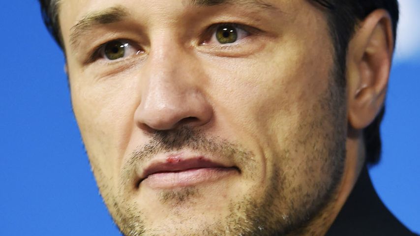 WM-Nacktskandal: Dieser Knackpo sorgt für Ärger!