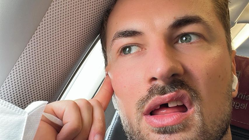 Schneidezahn verloren: Nicolas Puschmann bricht Urlaub ab