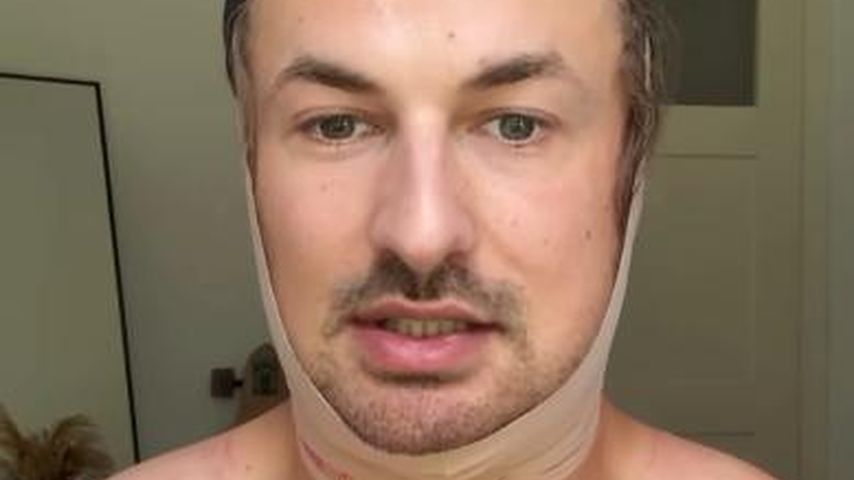 Nicolas Puschmann hatte vierte Brust-OP sowie Fettabsaugung