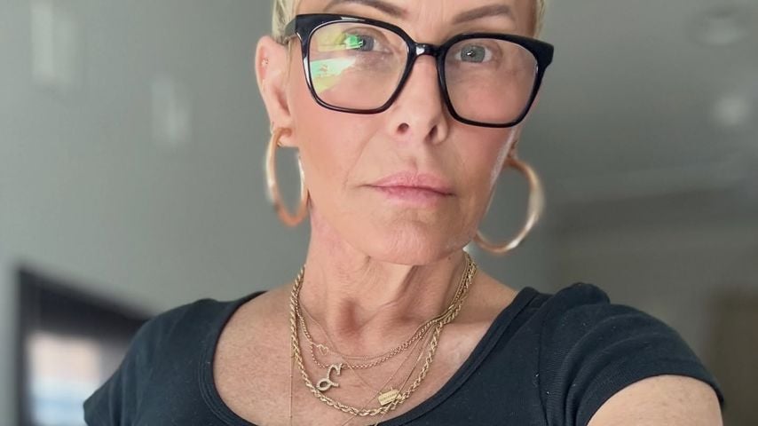 Nicole Eggert nach ihrer OP