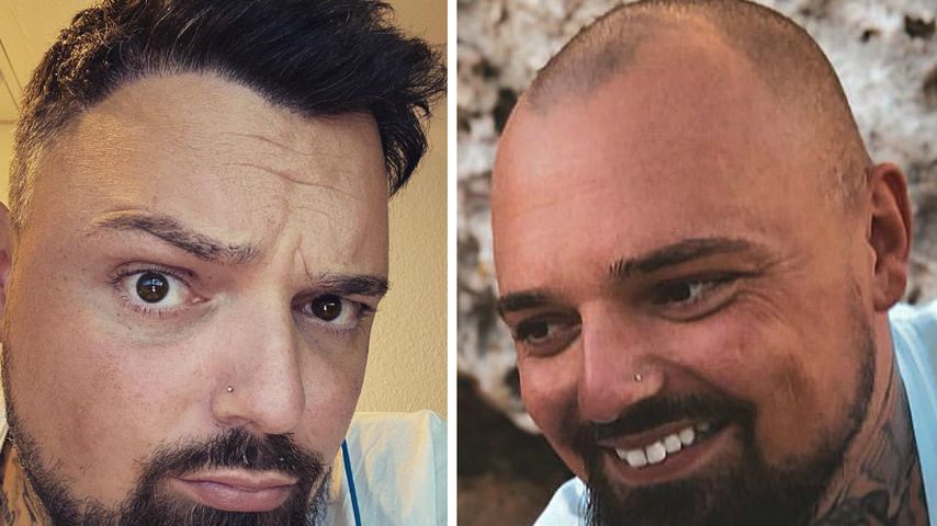 Nach sieben Jahren Glatze: Nik Schröder hat endlich Haare!