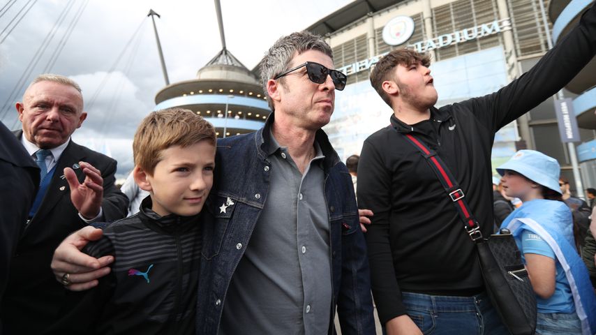 Während Man-City-Spiel: Noel Gallagher war blutüberströmt!