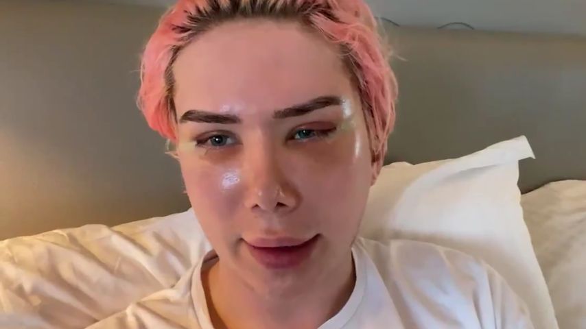 Oli London stellt klar: BTS nicht Hauptgrund für Beauty-OPs