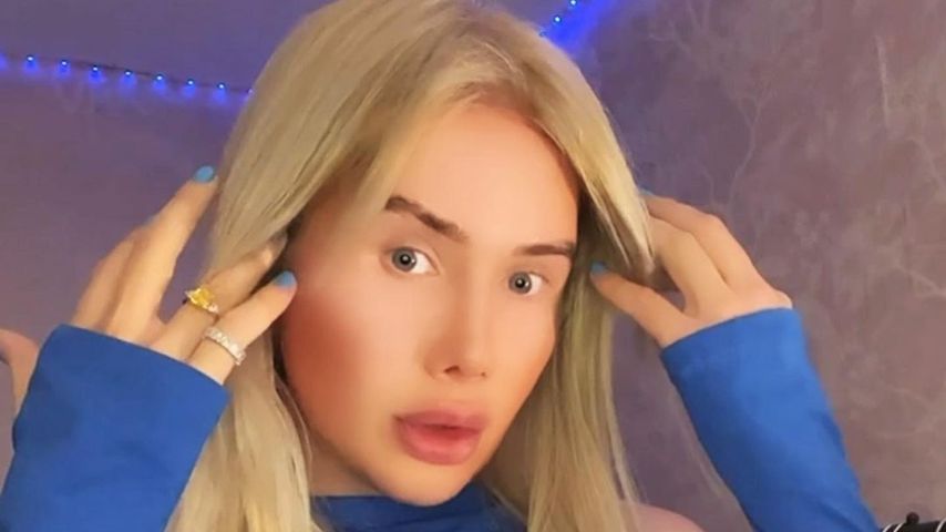 32 Operationen für K-Pop-Look: Oli London entschuldigt sich!