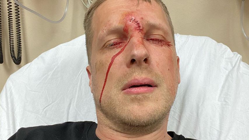 "Zum Leidwesen von mir": Oliver Pocher erklärt Jagdunfall!