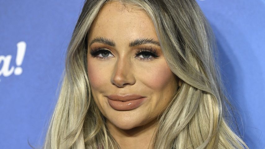 Olivia Attwood reflektiert über Brust-OPs und Kinderplanung