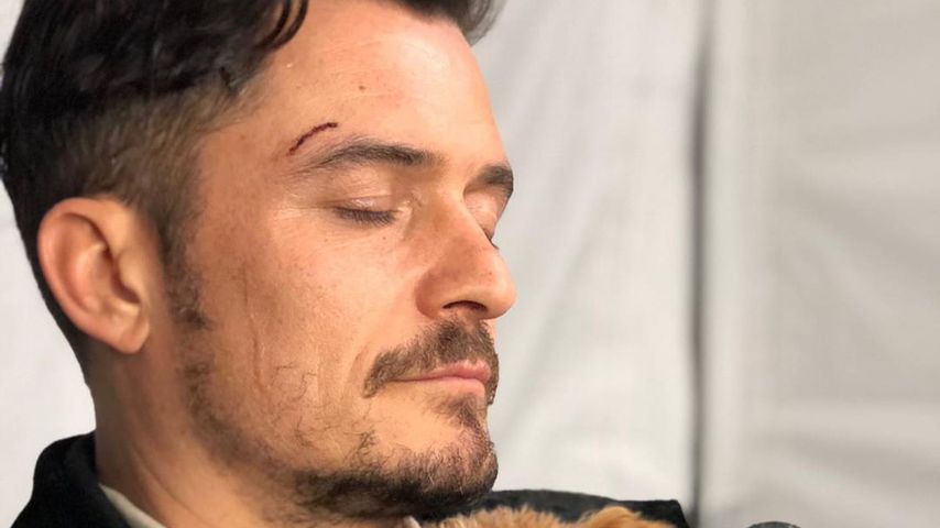 Traurige Gewissheit: Orlando Blooms Hund Mighty ist tot