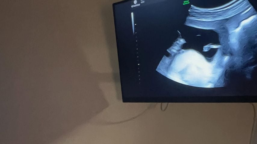 Oscar Hugo vor dem Ultraschallbild