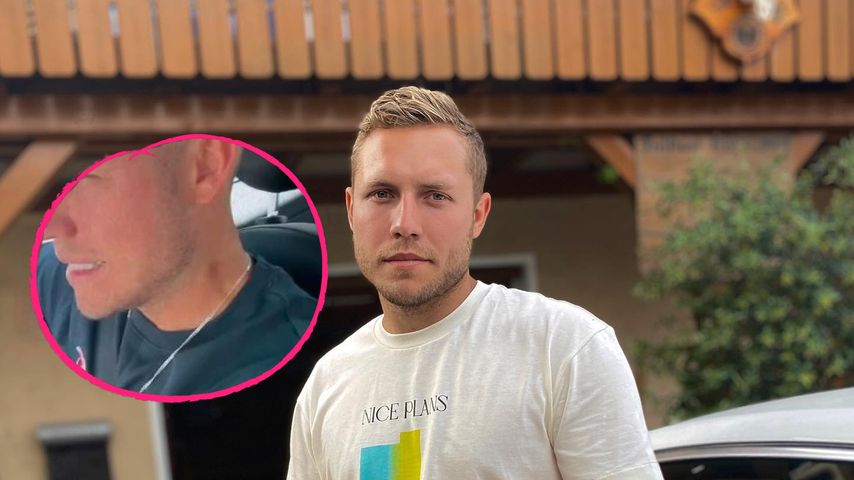 Von Gloria? Patrick Romer hat fetten Knutschfleck am Hals