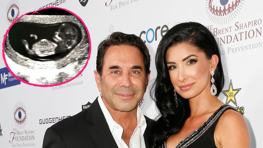 "Botched"-Star Paul wird mit 57 Jahren noch einmal Vater!