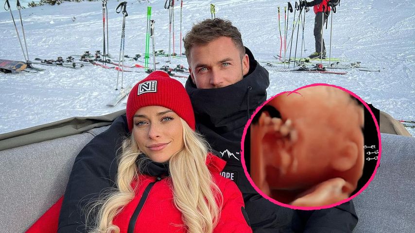 Philipp Stehler und Vanessa zeigen erste Baby-Aufnahmen!