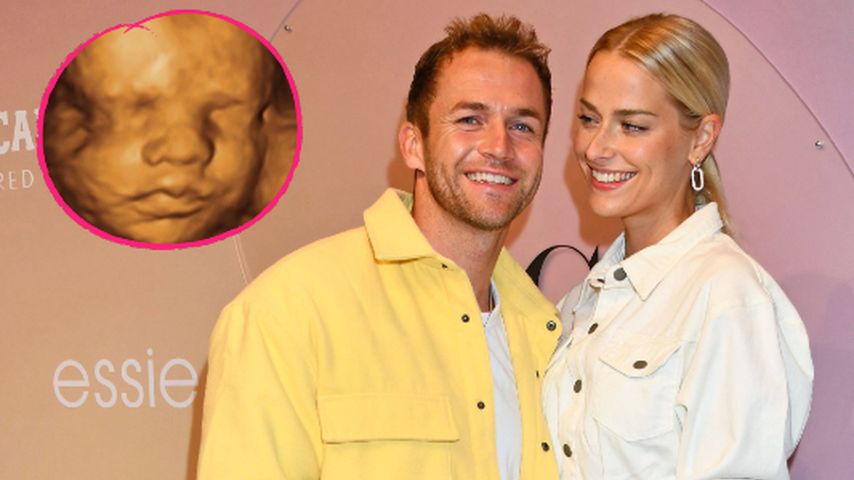 Philipp Stehler und Vanessa zeigen das Gesicht ihres Babys
