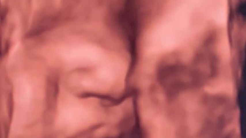 Philipp Stehler und Vanessa Ciombers Baby im 3-D-Ultraschall