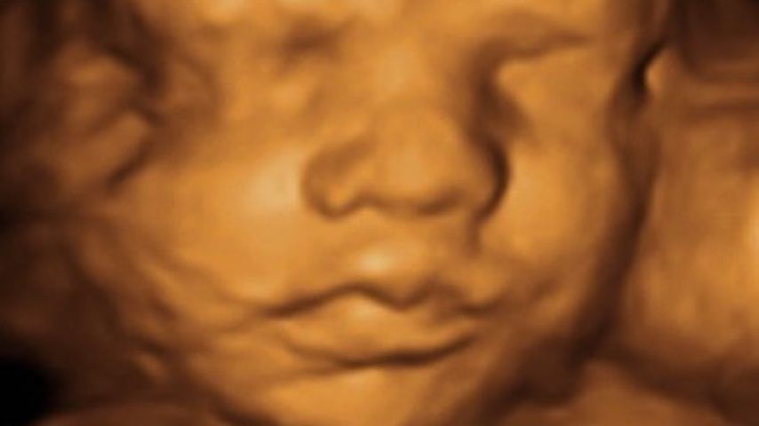 Philipp Stehler und Vanessa Ciombers Baby im 3-D-Ultraschall