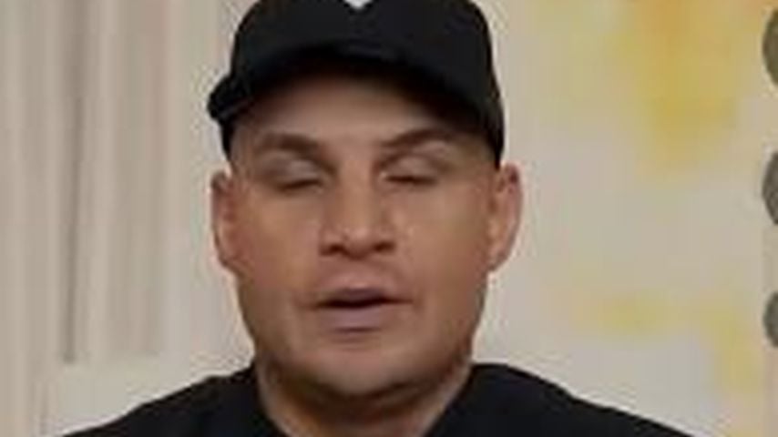 Pietro Lombardi, Vorher-Bild