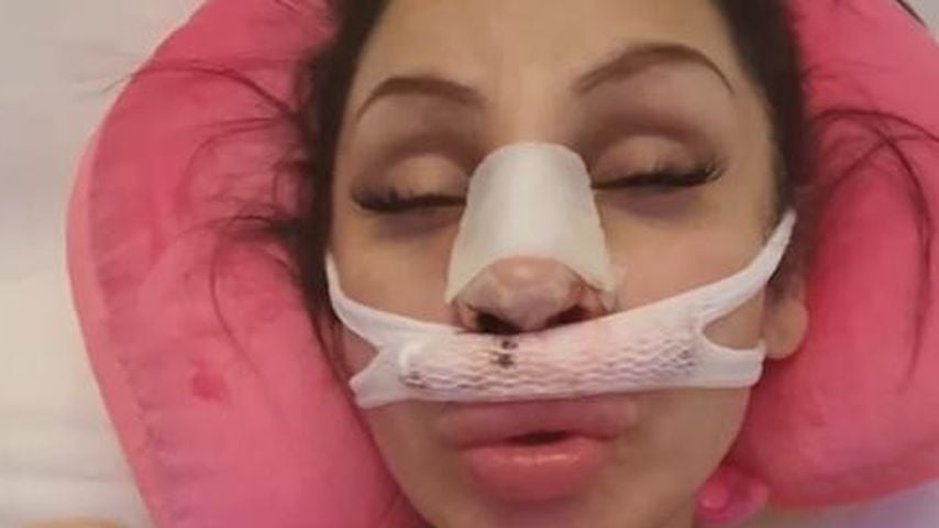 "Todesschmerzen": Pinar Sevim zeigt Gesicht nach Beauty-OP