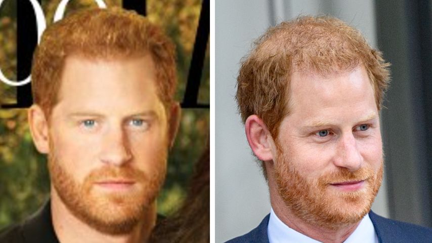"Retusche": Harrys Haar auf Cover ganz anders als in echt