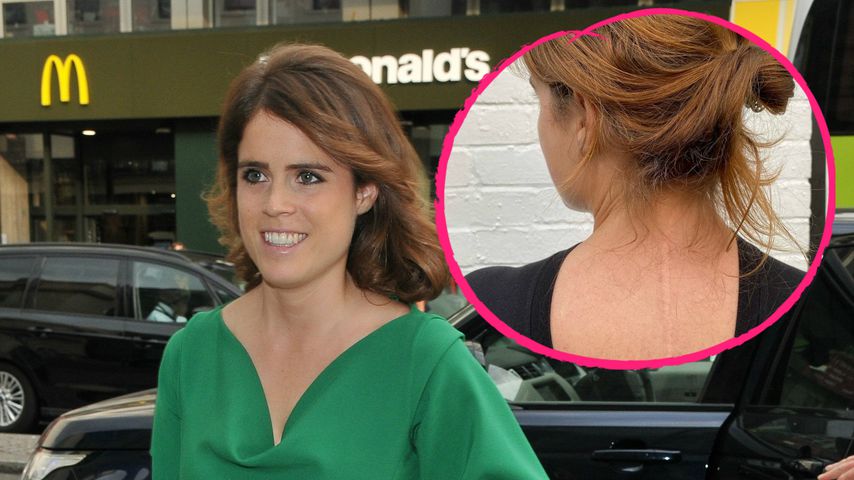 "Stolz": Prinzessin Eugenie zeigt ihre Skoliose-Narbe