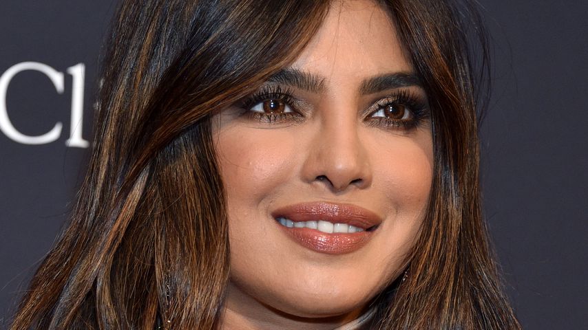 Priyanka Chopra erklärt: Darum hatte sie mehrere Nasen-OPs