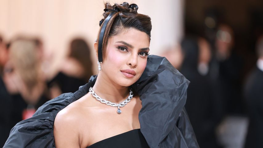 Priyanka Chopra wurde nach verpfuschter Nasen-OP depressiv