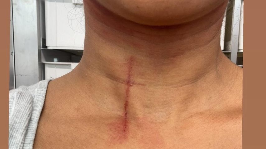 Priyanka Chopras Stuntverletzung beim Dreh von "The Bluff"